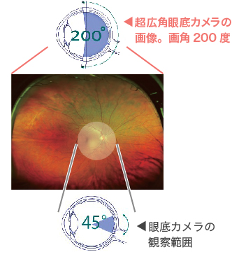 画角200度で広範囲の眼底像を素早く記録